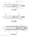 Fig. 14 - Method of implanting an adjustable occlusion device