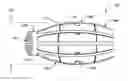 Fig. 01 - BISTABLE BODY LUMEN FILTER ANCHORS