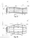 Fig. 02 - BISTABLE BODY LUMEN FILTER ANCHORS