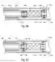 Fig. 07 - BISTABLE BODY LUMEN FILTER ANCHORS