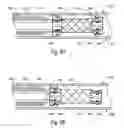 Fig. 08 - BISTABLE BODY LUMEN FILTER ANCHORS