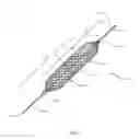 Fig. 02 - Temporary vascular filter