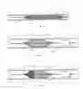 Fig. 04 - Temporary vascular filter