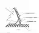 Fig. 04 - Sciatic Relief Device