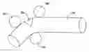 Fig. 01 - MODIFIED PLUG FOR ARTERIOTOMY CLOSURE