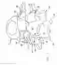 Fig. 02 - Multiple facet joint replacement