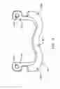 Fig. 07 - Multiple facet joint replacement