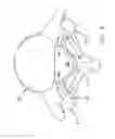 Fig. 09 - Multiple facet joint replacement