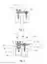Fig. 02 - ROD SCREW DYNAMIC IMPLANT FOR STABILIZING A VERTEBRAL COLUMN