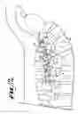 Fig. 08 - Dynamic stabilization medical implant assemblies and methods