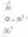 Fig. 07 - Reduced Bone Fracture Fixation Device