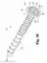 Fig. 09 - LOCKING MECHANISMS FOR PIVOTING BONE ANCHORS