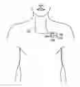 Fig. 01 - System and method for testing neural stimulation threshold