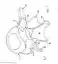 Fig. 02 - Prothesis for the replacement of a posterior element of a vertebra