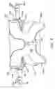 Fig. 07 - Prothesis for the replacement of a posterior element of a vertebra