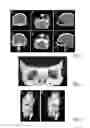 Fig. 06 - Generating model data representing a biological body section