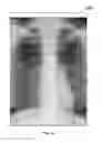Fig. 15 - SYSTEMS AND METHODS FOR LARGE DATA SET NAVIGATION ON A MOBILE DEVICE