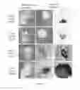 Fig. 11 - Prostate cancer cell lines and their use in screening method