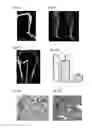 Fig. 12 - Prostate cancer cell lines and their use in screening method