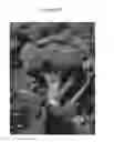 Fig. 06 - Broccoli type adapted for ease of harvest