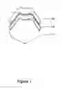 Fig. 02 - Flexible nose guard