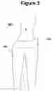 Fig. 04 - PANTYHOSE GARMENT AND METHOD OF MAKING