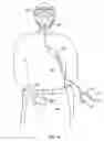 Fig. 05 - Protective suit for an individual and related assembly