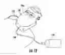 Fig. 13 - Patient support with universal energy supply system