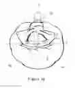 Fig. 03 - Pillow having speakers
