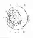 Fig. 23 - Pillow having speakers