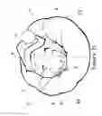 Fig. 25 - Pillow having speakers