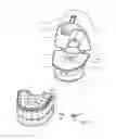 Fig. 28 - Vacuum cleaner with a removable screen