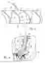 Fig. 03 - Aerodynamic device for thrust reverser cascades