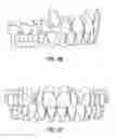 Fig. 07 - Torque Overcorrection Model
