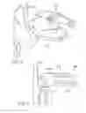 Fig. 07 - KICKBACK DETECTION METHOD AND APPARATUS