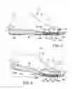 Fig. 03 - Sole assembly for article of footwear exhibiting posture-dependent characteristics