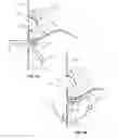 Fig. 09 - Selective animal feeder