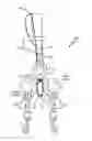Fig. 01 - MULTIPLE PET LEASH