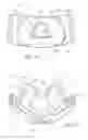 Fig. 14 - NASAL MASK ASSEMBLY