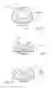 Fig. 20 - NASAL MASK ASSEMBLY