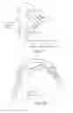 Fig. 23 - NASAL MASK ASSEMBLY