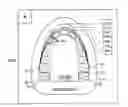 Fig. 01 - Method and system for sizing an oral device