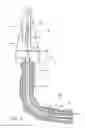 Fig. 02 - Anchor for use with expandable tubular