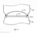 Fig. 12 - Interlocking cans