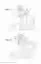 Fig. 11 - Hemodialysis system with cassette and pinch clamp