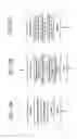 Fig. 11 - Method and composition for removing uremic toxins in dialysis processes