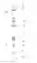 Fig. 01 - Bottom control type specimen filtering container and filtering method thereof