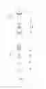 Fig. 07 - Bottom control type specimen filtering container and filtering method thereof