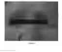 Fig. 03 - Extended length botulinum toxin formulation for human or mammalian use
