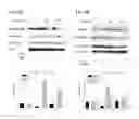 Fig. 04 - METHODS FOR SUPPRESSING AN IMMUNE RESPONSE OR TREATING A PROLIFERATIVE DISORDER